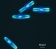 Sladkovodní rozsivka Pinnularia – buňka s protoplastem a jádrem barveným DAPI ve fluorescenci. Foto A. Poulíčková 