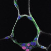 Na fluorescenčním snímku řezu zánětlivým ložiskem je patrná vrstva zeleně zvýrazněných makrofágů (protilátka proti F4/80) kolem nekrotického adipocytu – na rozdíl od okolních živých adipocytů nemá na povrchu tukové kapénky bílou vrstvu perilipinu. Modře jádra (obarvena DAPI) a fialově dělící se jádra (Ki67). Foto K. Bardová