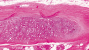 Hyalinní chrupavka, histologický preparát barvený hematoxylinem  a eozinem. Tuhé kolagenní vazivo  perichondria (3) postupně přechází  do chrupavčité tkáně. Chondrocyty (vyznačené šipkou) jsou uloženy v lakunách a tvoří skupiny – izogenetické  jednotky (1). Obklopuje je extracelulární matrix (2), která se ve světelném mikroskopu jeví amorfní, protože kolagen  typu II netvoří vlákna v pravém slova smyslu, ale pouze jemné fibrily. Foto M. Halašková, Ústav histologie a embryologie 3. lékařské fakulty UK