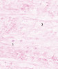 Vazivová chrupavka, histologický preparát barvený hematoxylinem a eozinem. Chondrocyty (1) jsou v lakunách jednotlivě i ve skupinách obklopené extracelulární matrix (2), ve které jasně dominují husté svazky vláken kolagenu typu I. Foto M. Halašková, Ústav histologie a embryologie 3. lékařské fakulty UK