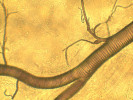 Rozvětvená vzdušnice (trachea) na povrchu trávicí soustavy švába amerického (Periplaneta americana). Dobře patrná je spirální výztuha vzdušnice (taenidium), která připomíná hadici vysavače. Foto J. Mourek 