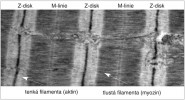 Sarkomera v transmisním elektronovém mikroskopu na podélném řezu svalem. Sarkomery (délka 2,4 mm) jsou ohraničeny Z-disky (tmavé linie), do kterých jsou ukotvena tenká filamenta (světlé pruhy). Ve středu jsou tlustá filamenta (tmavý pruh). Upraveno podle: T. Sorsa a kol. (2004). Orig. B. Elsnicová 