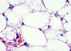 Histologický snímek podkožní tukové tkáně myši chované v chladu. Na snímku se objevují menší tukové kapénky – dochází k hnědnutí. Fialově hematoxylin – jádra; růžově eozin – cytoplazma, hlavně erytrocyty; neobarvené – tukové kapénky. Navíc je zde vidět několik cév s červenými krvinkami. Foto K. Bardová