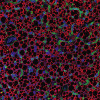 Řez hnědou tukovou tkání potkana, kde je patrné bohaté cévní zásobení (zeleně, zvýrazněno izolektinem) a multilokulární adipocyty, u nichž na každé modré jádro (DAPI) připadá několik červeně ohraničených tukových kapének (protilátka proti perilipinu). Foto K. Bardová