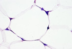 Histologický snímek podkožní tukové tkáně myši chované v termo­neutrální teplotě. Na snímku velké unilokulární tukové buňky – adipocyty. Fialově hematoxylin – jádra; růžově eozin – cytoplazma, hlavně erytrocyty; neobarvené – tukové kapénky. Foto K. Bardová