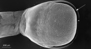 Ventrální strana prstu bezblanky dvojtečné (Pristimantis bipunctatus). Oblast Chanchamayo, Peru. Obvodová rýha oddělující běžný povrchový epitel ventrálního terčíku od adhezivního. Foto ze skenovacího elektronového mikroskopu (SEM). Foto J. Bulantová