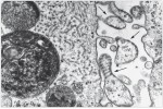 Paramyxoviry (šipky) jsou patogenní viry obratlovců, jejichž genomem je jednovláknová RNA v minus smyslu. Patří k nim např. virus spalniček nebo příušnic. Foto H. M. Lairdová