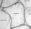 Detail endodermis na snímku z transmisního elektronového mikroskopu. Casparyho proužky jsou patrné jako  tmavé oblasti buněčných stěn (šipky). Foto E. Tylová