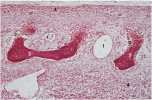 Desmogenní osifikace (mikroskopický preparát). 1 – krevní cévy, 2 – řada osteoblastů, 3 – kostní trámec – primární houbovitá kostní tkáň (spongióza), 4 – budoucí periost (barveno eozinem). Foto O. Naňka