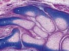 Chrupavčité základy kostí nohy, kde se v místech počínající osifikace začínají objevovat hypertrofické chondrocyty (označeny hvězdičkou). Kloubní štěrbiny jsou již vytvořeny. Základy kostí už nesou hlavní tvarové charakteristické rysy. Lidské embryo, 8. týden vývoje. Foto O. Naňka