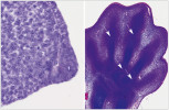 Končetinový pupen s apikální hřebenovou lištou (AER, vlevo). 1 – ektoderm na povrchu zesílený v AER, 2 – mezenchym pod AER obsahuje proliferující (dělící se) buňky, jsou patrné četné mitózy. Vpravo primitivní chrupavčitý základ kostí ruky člověka 44. den embryonálního vývoje. Chrupavka je obarvena modře, prsty nejsou dosud oddělené, ani nejsou otevřené budoucí jednotlivé kloubní štěrbiny (viz šipky). Foto O. Naňka