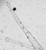 Žláznaté trichomy lilku černého (Solanum nigrum), patrné jsou koncové sekreční buňky a jádra v buňkách stopky trichomu. Foto P. Šíma