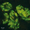 Symbionti v buňkách červců (FISH, buňky nejsou zobrazeny).  Zeleně vnější bakterie Tremblaya princeps, oranžově vnitřní bakterie Moranella endobia. Foto z archivu F. Husníka