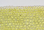 Malé, izodiametrické a výrazně papilnaté buňky listů xerofytního mechu vijozubu nachýleného (Tortella inclinata). Foto L. Janošík