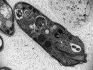 Snímek z transmisního elektronového mikroskopu ukazuje ultrastrukturu dosud nepopsaného zástupce rodu Diplonema (prozatím označovaného číslem 1603). V přední části buňky si všimněte vystupujícího hltanu (pharynxu), v zadní části tří endosymbiontů. Mitochondrie jsou uloženy na okrajích buňky, v níž se nachází i množství vakuol sloužících k trávení potravyNěkolik buněk  mořského prvoka  označovaného Diplonema sp. 2.  Tento druh byl poprvé  izolován z mořského  akvária (Gaithersburg Pet Center, Maryland, USA) v r. 1986. Jde o příbuzného  všudypřítomných druhů diplonem skupiny DSPDI (Deep Sea Pelagic Diplonemids I). Všimněte si charakte­ristického žlábku  v přední části buňky stáčejícího se okolo  flagelární kapsy,  ze které vyrůstají bičíky.  Snímek ze skenovacího elektronového mikroskopu. Foto G. Prokopchuk
