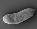 Nepopsaný diplonemid s číslem 1515 z rodu Rhynchopus ve skenovacím elektronovém mikroskopuNěkolik buněk  mořského prvoka  označovaného Diplonema sp. 2.  Tento druh byl poprvé  izolován z mořského  akvária (Gaithersburg Pet Center, Maryland, USA) v r. 1986. Jde o příbuzného  všudypřítomných druhů diplonem skupiny DSPDI (Deep Sea Pelagic Diplonemids I). Všimněte si charakte­ristického žlábku  v přední části buňky stáčejícího se okolo  flagelární kapsy,  ze které vyrůstají bičíky.  Snímek ze skenovacího elektronového mikroskopu. Foto G. Prokopchuk