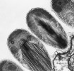 Epixenozomy – vejčité útvary sloužící k obraně proti predaci na povrchu nálevníka Euplotidium itoi. TEM, foto G. Rosati. Všechny snímky převzaty v souladu s podmínkami využití, přesnou citaci zdroje uvádíme v použité literatuře  na webové stránce Živy.