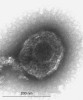 Vir Herpes simplex 1 (HSV-1) je v latentním stavu ukryt v gangliu trojklaného nervu a k reaktivaci dochází vlivem oslabení imunity.  Foto D. Krsek, Národní referenční laboratoř pro průkaz infekčních agens elektronovou mikroskopií, Státní zdravotní ústav 