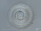 Složitá struktura aborálního disku  (na straně opačné než ústní otvor) brousilky vznášivkové, kterým klouže po povrchu hostitele. Blíže v textu. Foto M. Plewka, www.plingfactory.de, Německo 