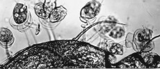 Plísenka Epistylis helicostylum z nožek lasturnatky rodu Eucypris  (Ostracoda). Báze zoitů jsou chráněny miskovitými výrůstky stonku. Foto J. Vávra 